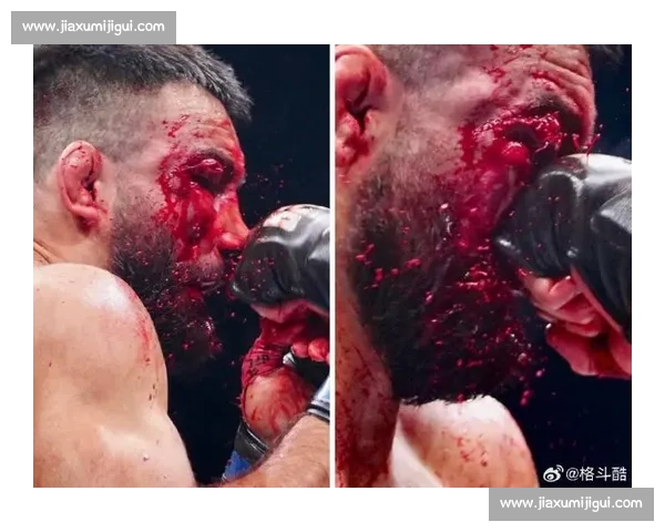 肘击定音！琼斯 UFC 巴黎赛 TKO 奥基延续连胜